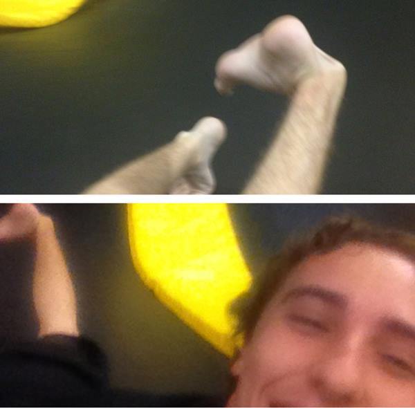 Self Picture Broken Ankle